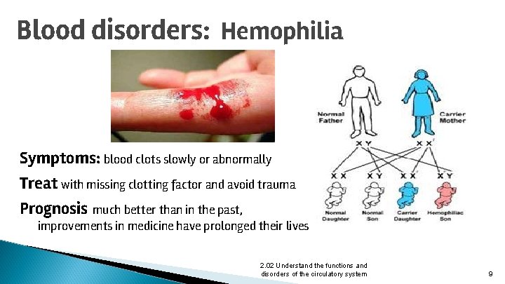 Blood disorders: Hemophilia Symptoms: blood clots slowly or abnormally Treat with missing clotting factor