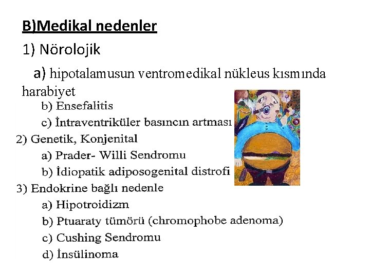 B)Medikal nedenler 1) Nörolojik a) hipotalamusun ventromedikal nükleus kısmında harabiyet 