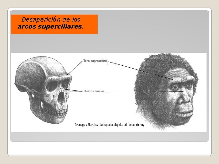 Desaparición de los arcos superciliares. 