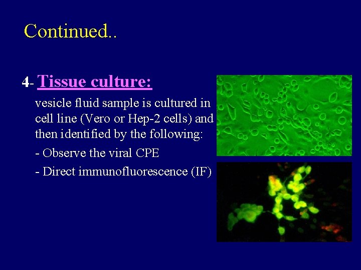 Continued. . 4 - Tissue culture: vesicle fluid sample is cultured in cell line