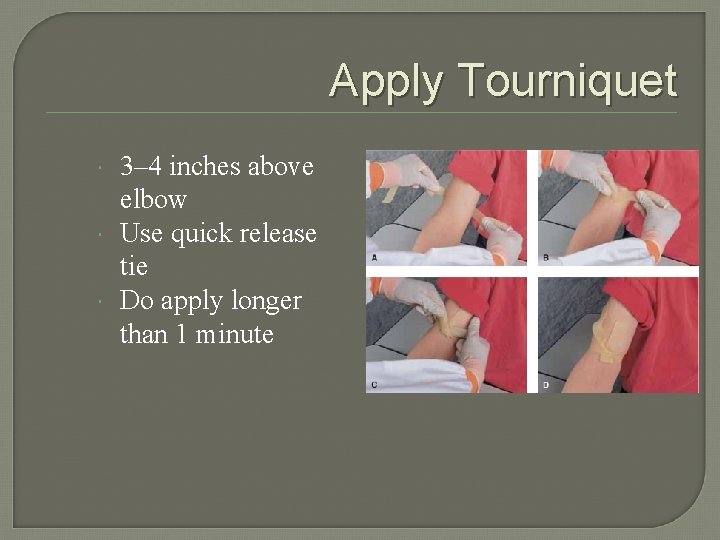 Apply Tourniquet 3– 4 inches above elbow Use quick release tie Do apply longer