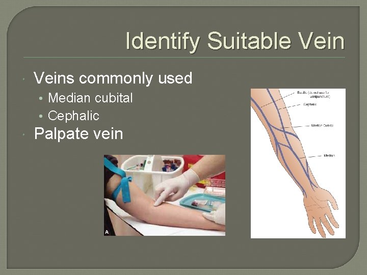 Identify Suitable Veins commonly used • Median cubital • Cephalic Palpate vein 