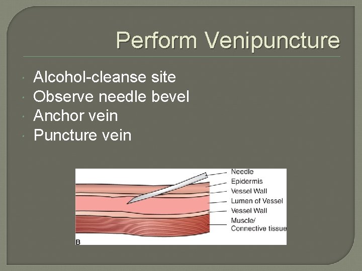 Perform Venipuncture Alcohol-cleanse site Observe needle bevel Anchor vein Puncture vein 