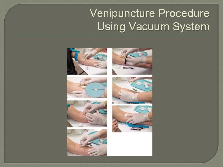 Venipuncture Procedure Using Vacuum System 