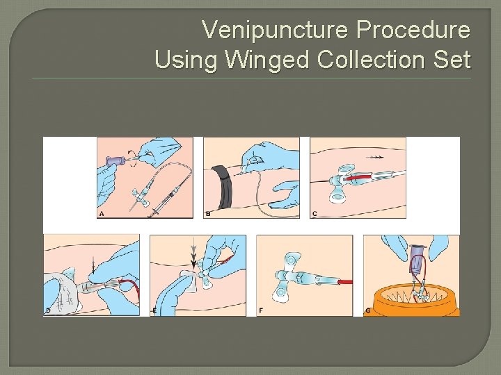 Venipuncture Procedure Using Winged Collection Set 