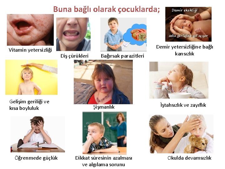 Buna bağlı olarak çocuklarda; Vitamin yetersizliği Gelişim geriliği ve kısa boyluluk Öğrenmede güçlük Diş