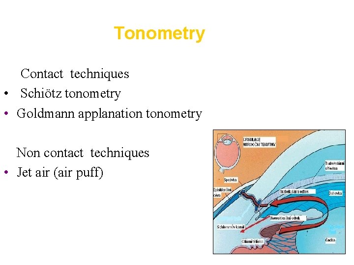 Tonometry Contact techniques • Schiötz tonometry • Goldmann applanation tonometry • Non contact techniques