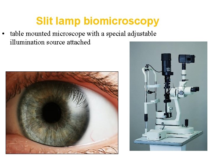 Slit lamp biomicroscopy • table mounted microscope with a special adjustable illumination source attached