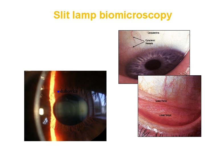 Slit lamp biomicroscopy nduhovka 