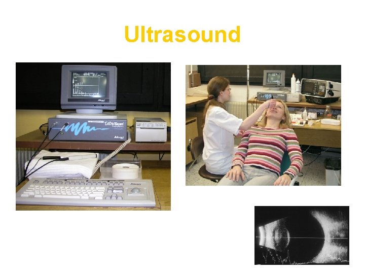 Ultrasound 