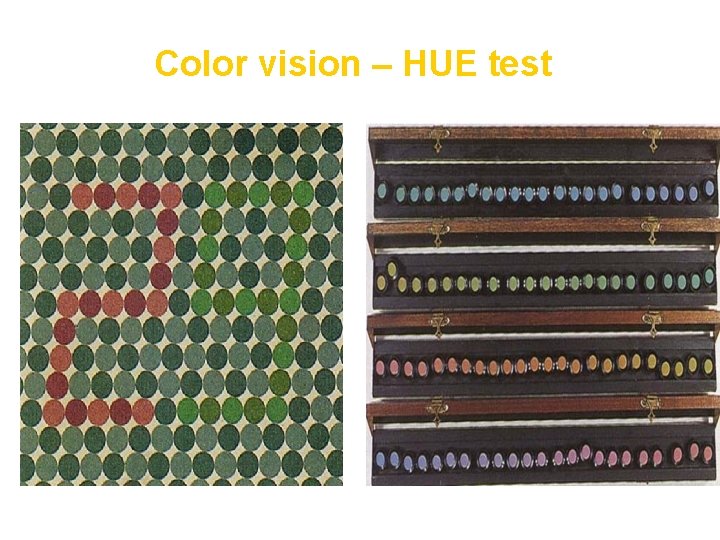 Color vision – HUE test 