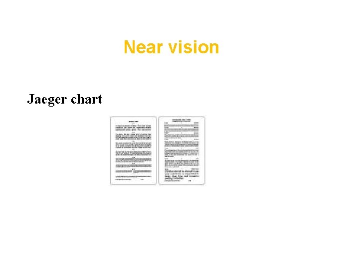 Near vision Jaeger chart 