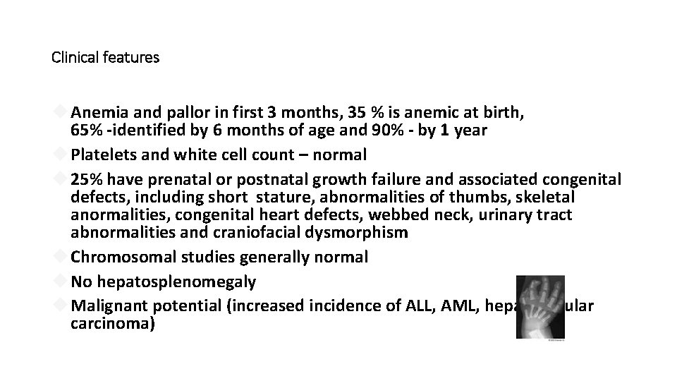 Clinical features Anemia and pallor in first 3 months, 35 % is anemic at