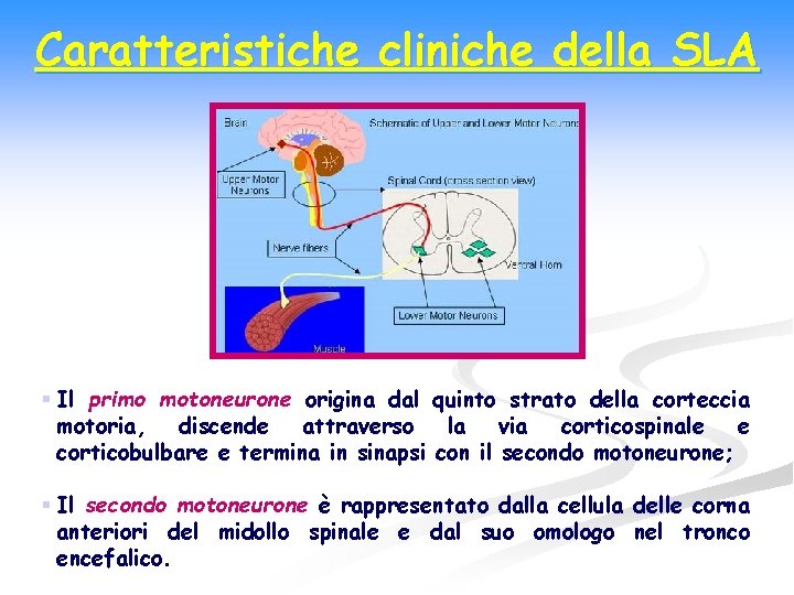 Caratteristiche cliniche della SLA § Il primo motoneurone origina dal quinto strato della corteccia