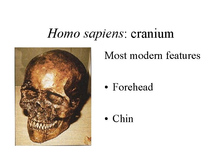 Homo sapiens: cranium Most modern features • Forehead • Chin 
