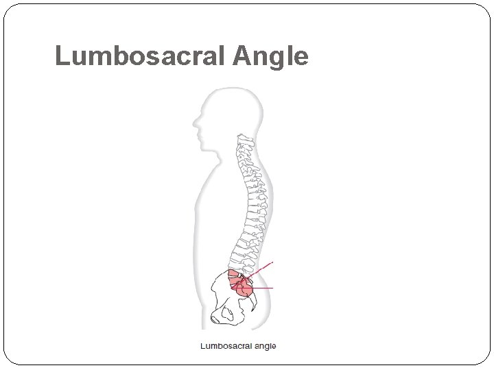 Lumbosacral Angle 