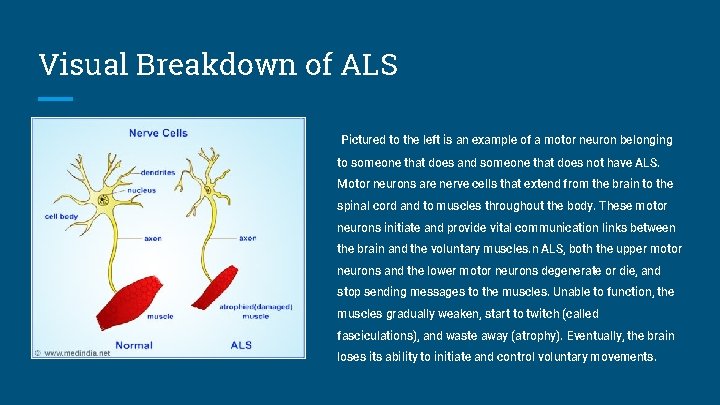 Visual Breakdown of ALS Pictured to the left is an example of a motor