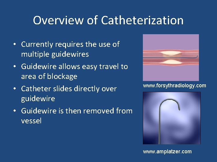 Overview of Catheterization • Currently requires the use of multiple guidewires • Guidewire allows