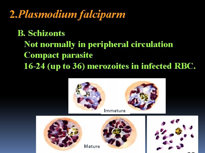 2. Plasmodium falciparm B. Schizonts Not normally in peripheral circulation Compact parasite 16 -24