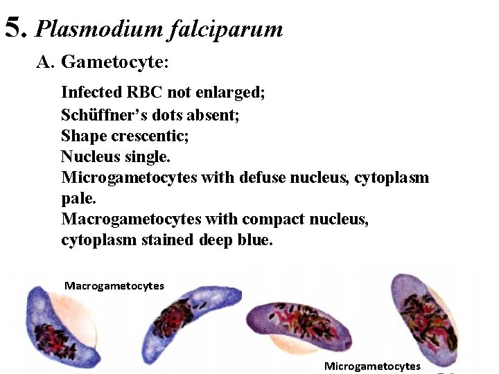5. Plasmodium falciparum A. Gametocyte: Infected RBC not enlarged; Schüffner’s dots absent; Shape crescentic;