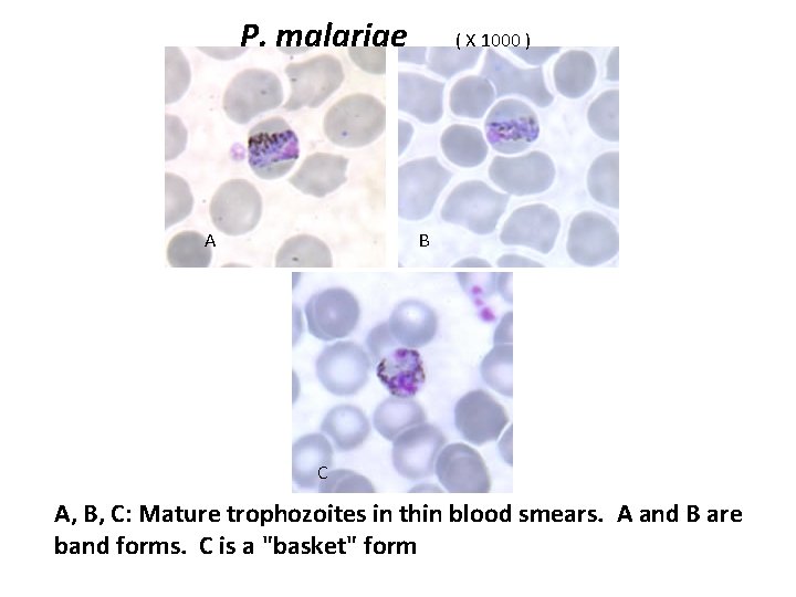 P. malariae ( X 1000 ) B A C A, B, C: Mature trophozoites