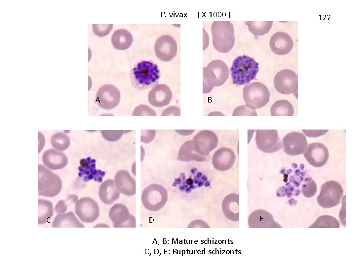 P. vivax A C ( X 1000 ) 122 B D A, B: Mature