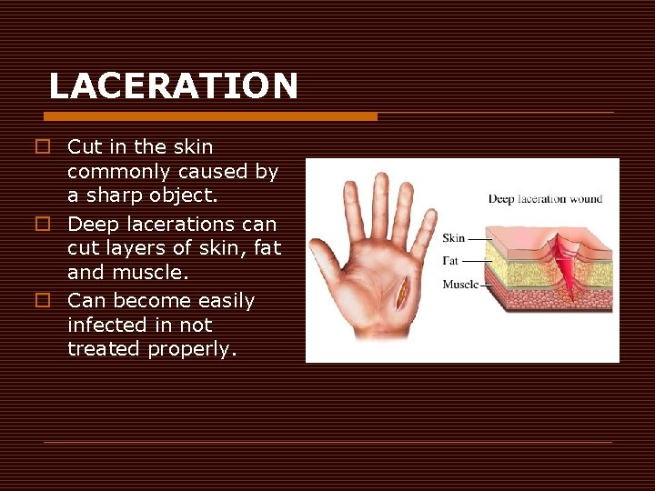 LACERATION o Cut in the skin commonly caused by a sharp object. o Deep