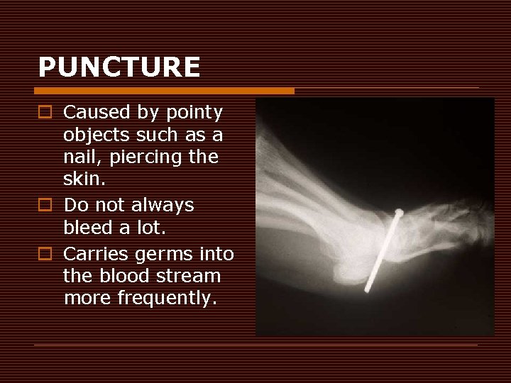PUNCTURE o Caused by pointy objects such as a nail, piercing the skin. o