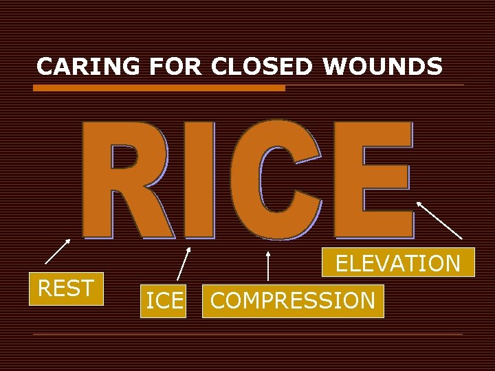 CARING FOR CLOSED WOUNDS REST ELEVATION ICE COMPRESSION 