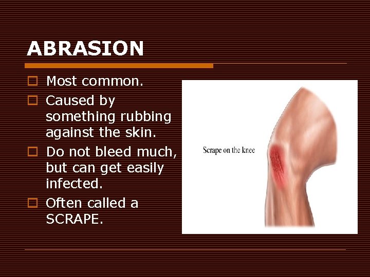 ABRASION o Most common. o Caused by something rubbing against the skin. o Do