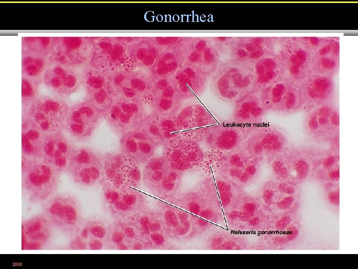 Gonorrhea 2008 Figure 26. 7 