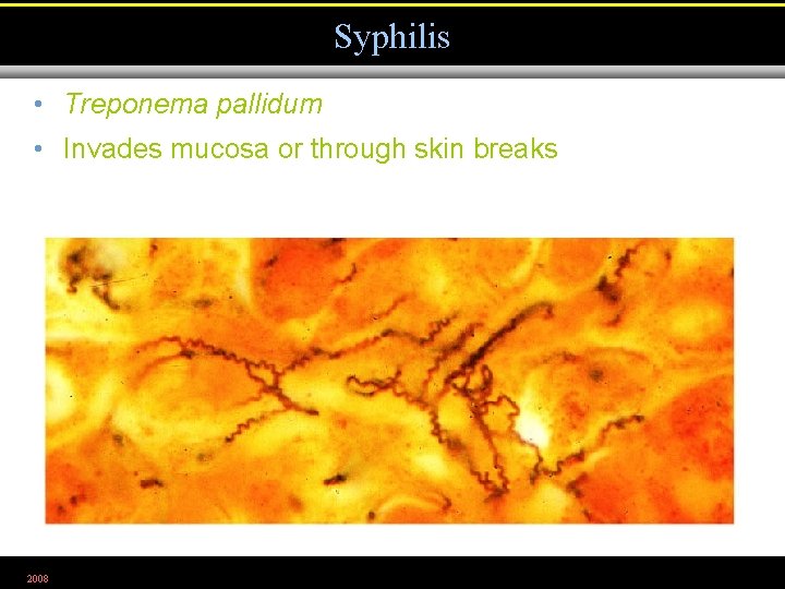 Syphilis • Treponema pallidum • Invades mucosa or through skin breaks 2008 Figure 26.