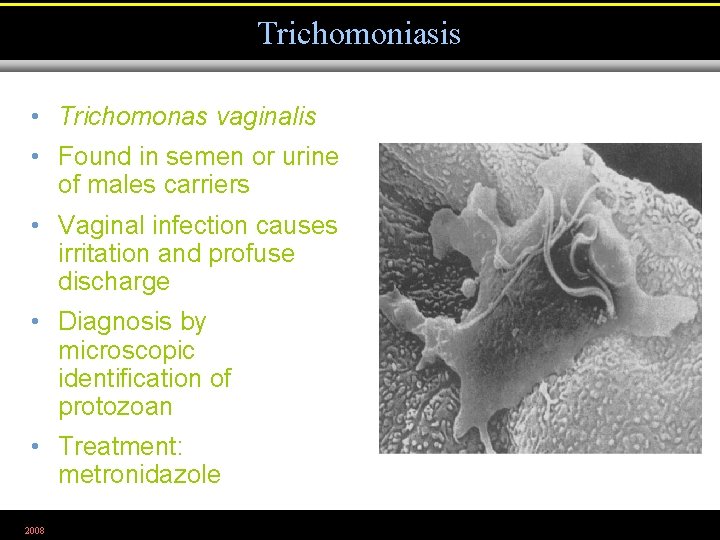 Trichomoniasis • Trichomonas vaginalis • Found in semen or urine of males carriers •