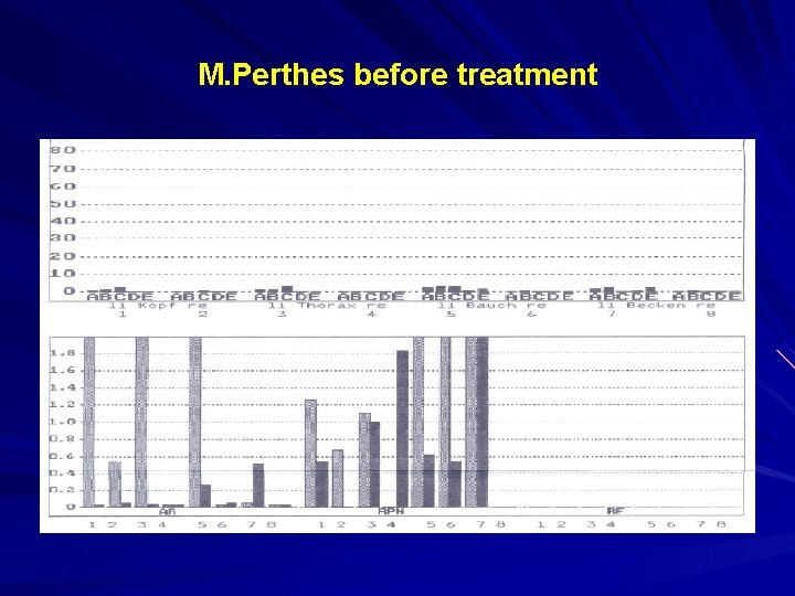 M. Perthes before treatment 