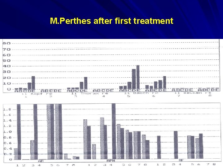 M. Perthes after first treatment 