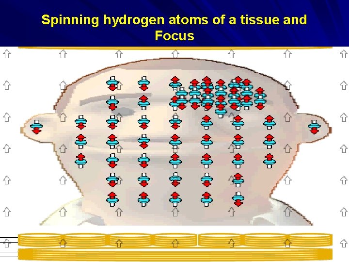 Spinning hydrogen atoms of a tissue and Focus 