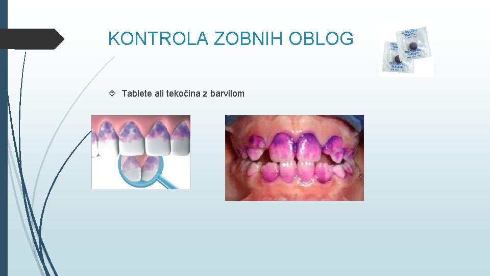 KONTROLA ZOBNIH OBLOG Tablete ali tekočina z barvilom 