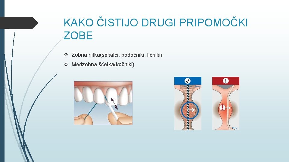 KAKO ČISTIJO DRUGI PRIPOMOČKI ZOBE Zobna nitka(sekalci, podočniki, ličniki) Medzobna ščetka(kočniki) 