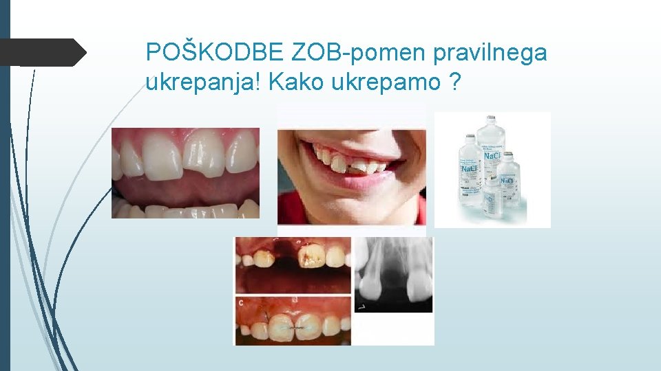 POŠKODBE ZOB-pomen pravilnega ukrepanja! Kako ukrepamo ? 