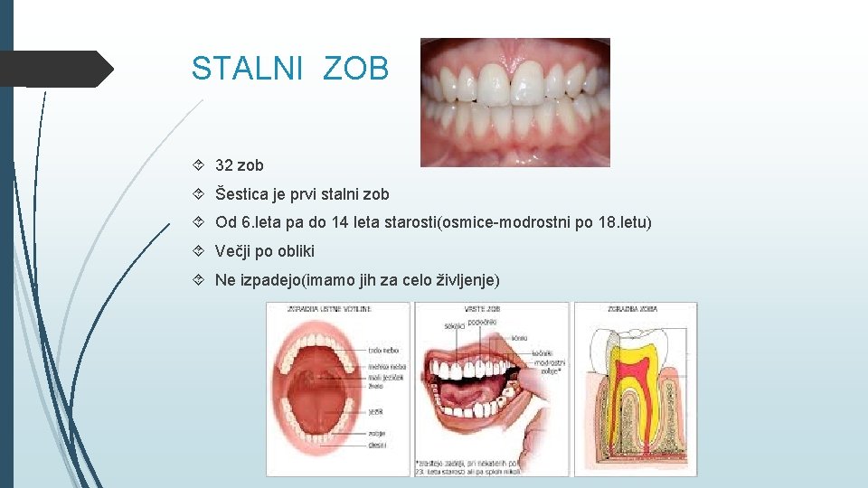 STALNI ZOB 32 zob Šestica je prvi stalni zob Od 6. leta pa do