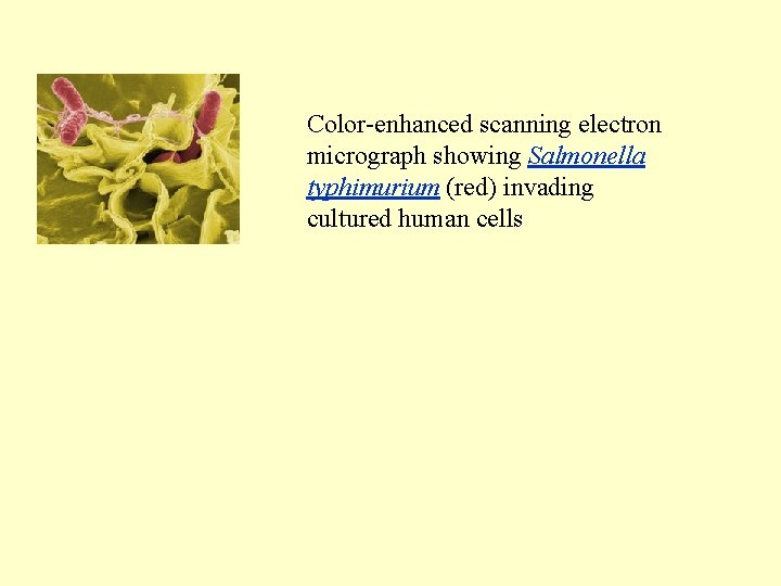 Color-enhanced scanning electron micrograph showing Salmonella typhimurium (red) invading cultured human cells 