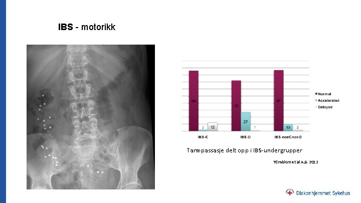 IBS - motorikk Tarmpassasje delt opp i IBS-undergrupper Törnblom et al AJG 2012 