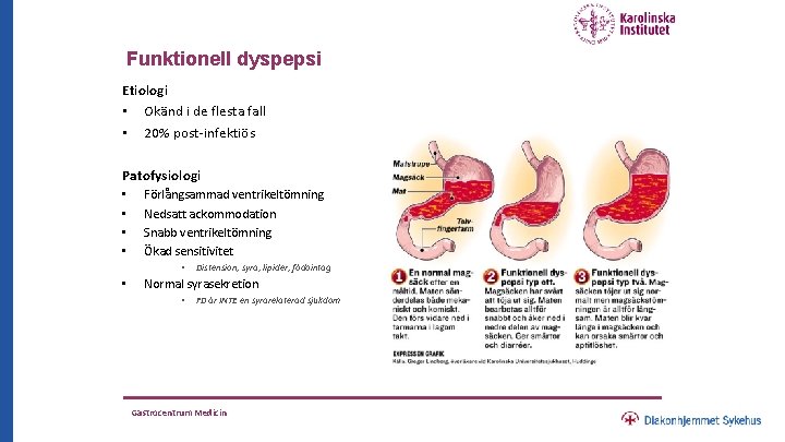 Funktionell dyspepsi Etiologi • Okänd i de flesta fall • 20% post-infektiös Patofysiologi •