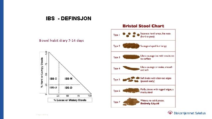 IBS - DEFINSJON Bowel habit diary 7 -14 days Greger Lindberg 8 