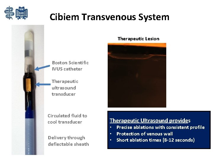 Cibiem Transvenous System Therapeutic Lesion Boston Scientific IVUS catheter Therapeutic ultrasound transducer Circulated fluid
