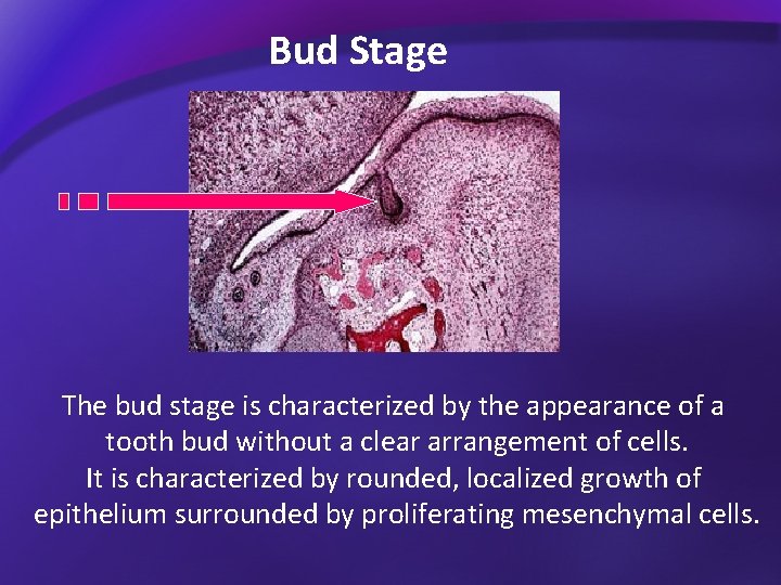 Bud Stage The bud stage is characterized by the appearance of a tooth bud