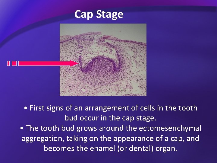Cap Stage • First signs of an arrangement of cells in the tooth bud