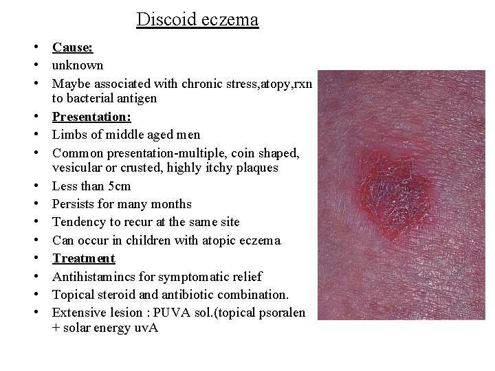 Discoid eczema • Cause: • unknown • Maybe associated with chronic stress, atopy, rxn