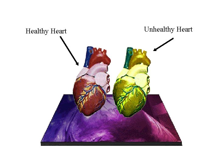 Healthy Heart Unhealthy Heart 