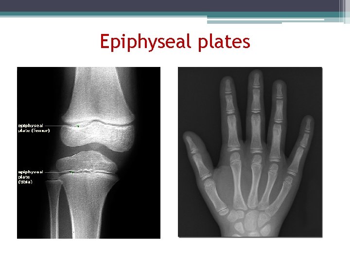 Epiphyseal plates 